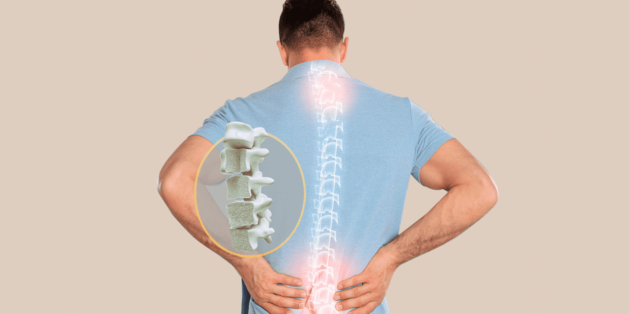 Penyakit Osteoporosis, Turunnya Kepadatan Tulang, Ini Sebabnya!