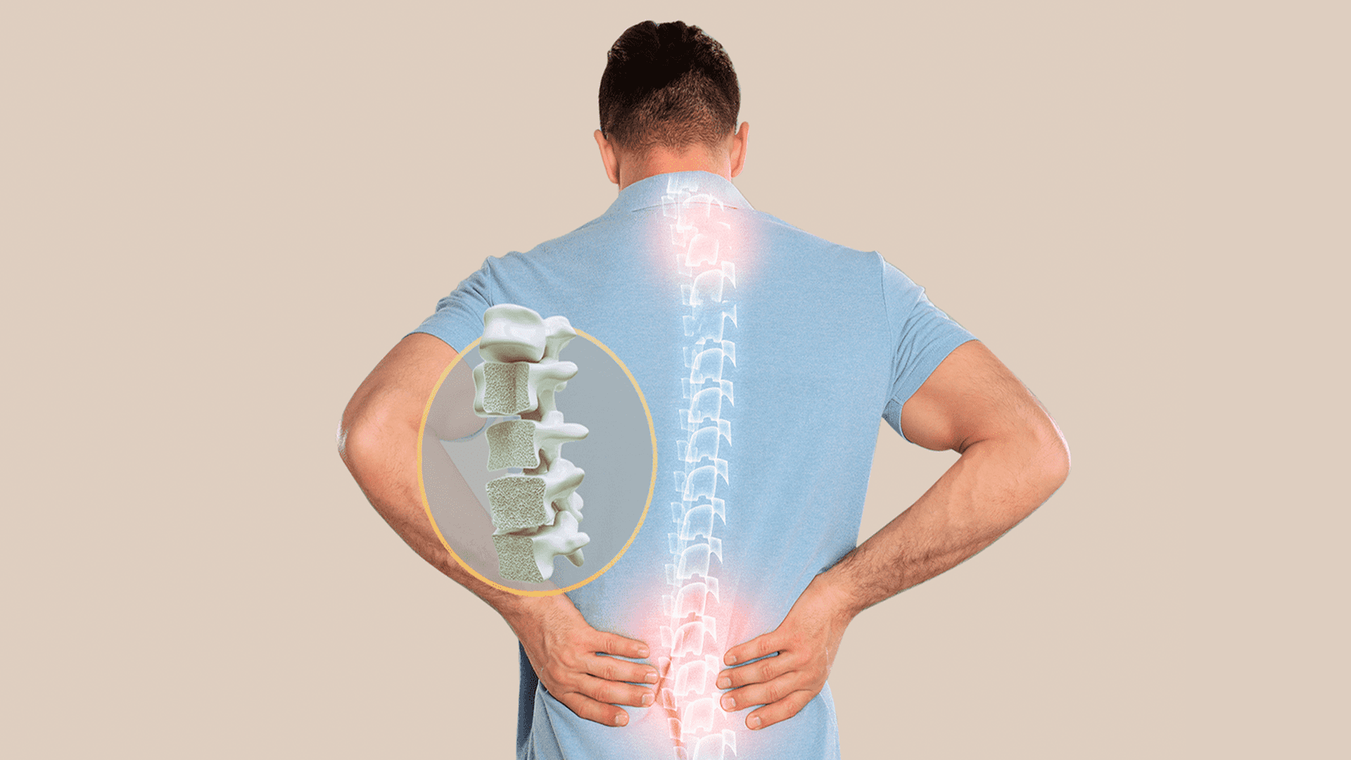 Penyakit Osteoporosis